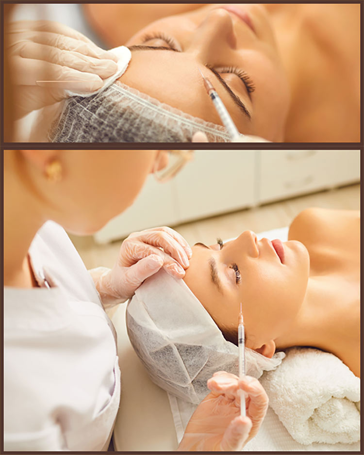 ボツリヌストキシン注射