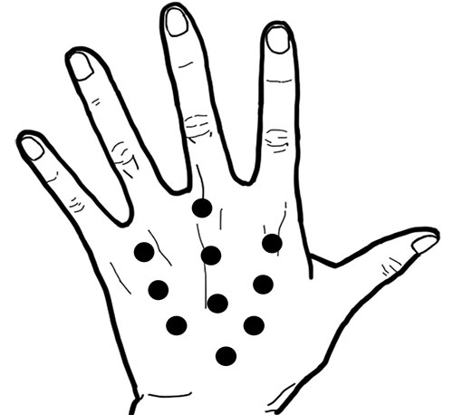 プロファイロ（次世代ヒアルロン酸）